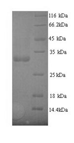 (Tris-Glycine gel) Discontinuous SDS-PAGE (reduced) with 5% enrichment gel and 15% separation gel.